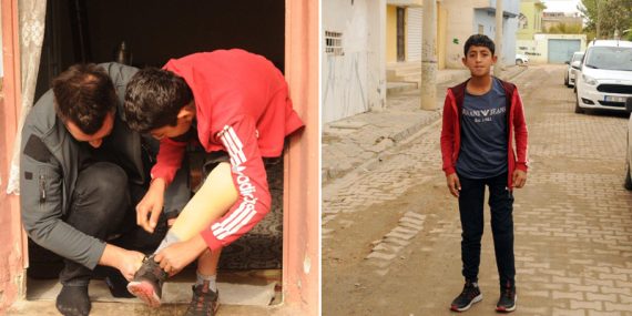 13 yaşındaki Rıfat yeni protez bacağa kavuştu