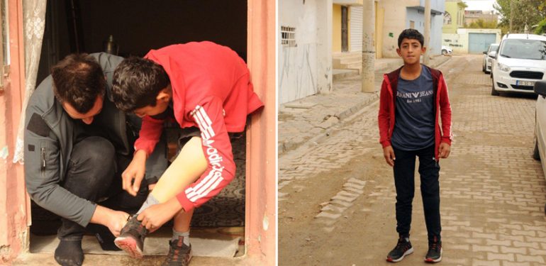 13 yaşındaki Rıfat yeni protez bacağa kavuştu