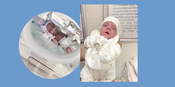 770 gram doğan Asiye bebek 3 ay sonra sağlığına kavuştu