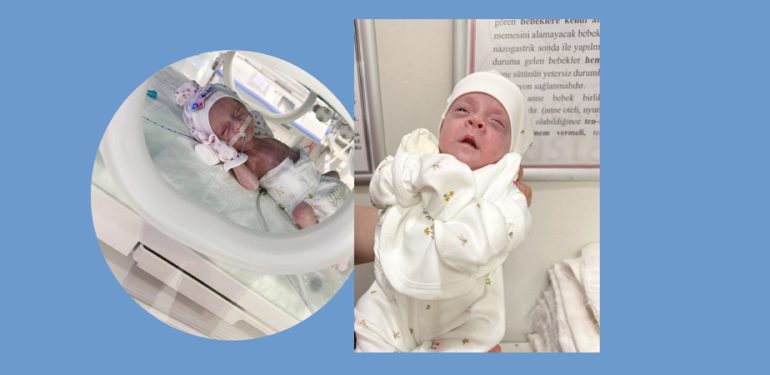 770 gram doğan Asiye bebek 3 ay sonra sağlığına kavuştu