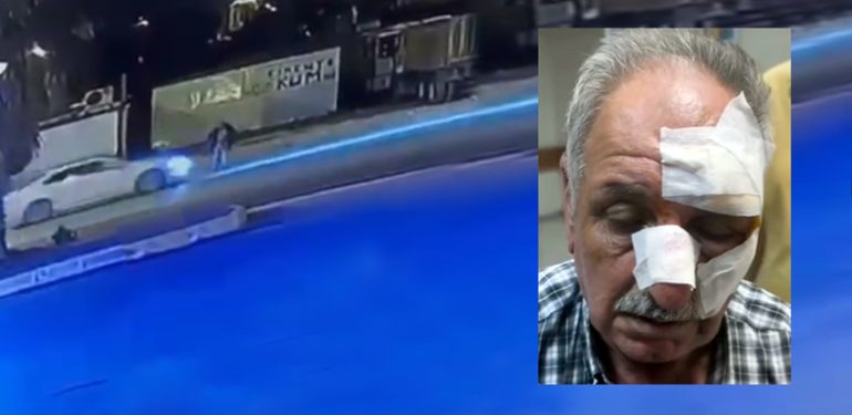 “Komiser Kado”ya çarpan sürücü gözaltına alındı