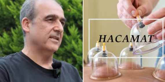 Fitoterapi Uzmanı Doktor Kılıç’tan Hacamat Uyarısı!